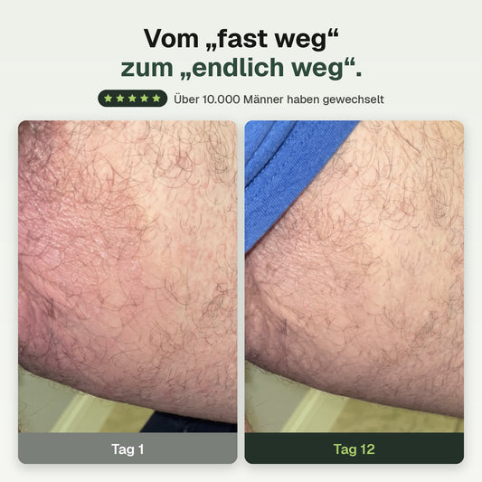 Unten Anti-Pilz-Seife